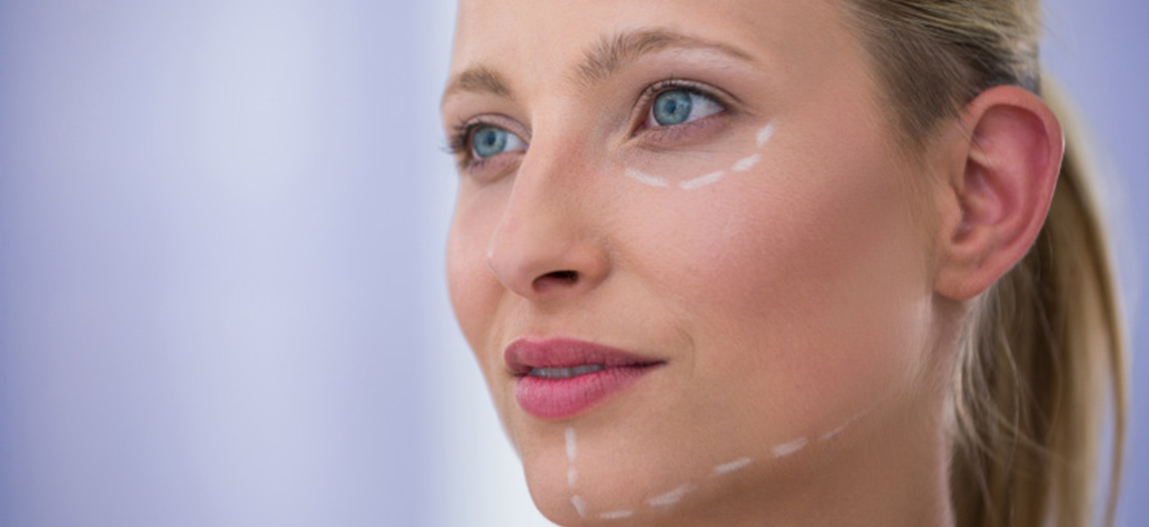 harmonizacao facial