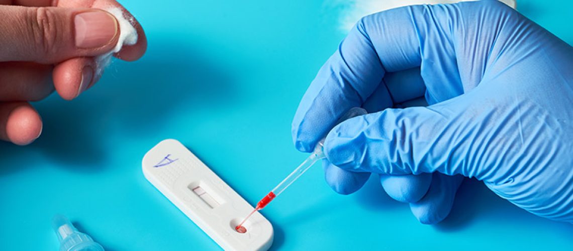 Teste rápido do COVID-19 para sindicalizados
